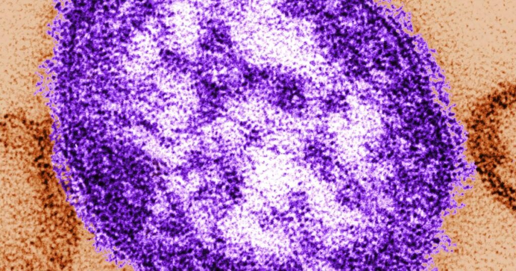 Strong reporting is a reminder that even a mild measles case can lead to serious disease, cellular damage