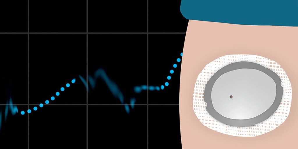 Users Report Issues With New Glucose Monitor Model