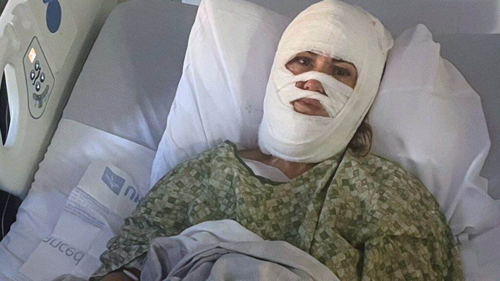 Chemical attack leaves Georgia woman hospitalized with third-degree burns
