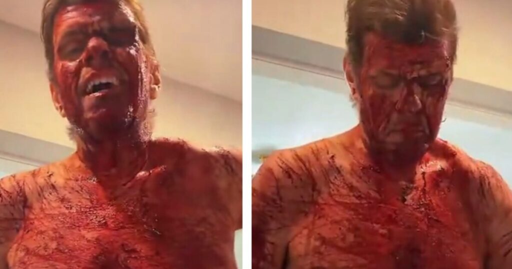 Celebrity Blogger Perez Hilton Self-Harms on TikTok Livestream – Fully Nude, Covered in Blood – Taken Away by Ambulance * The Gateway Pundit * by Cristina Laila